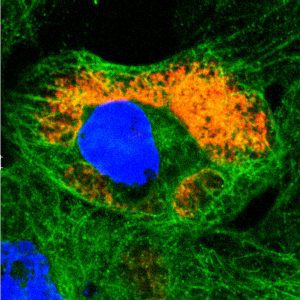 Reovirus in vivo interaction platform. The C-terminus of mammalian orthoreovirus protein μNS (amino acid region 471-721) forms cytosolic inclusions similar to globular mammalian orthoreovirus viral factories. These inclusions are directly detected by fusion to fluorescent proteins, such as mCherry, allowing their use as in vivo interaction platforms when fused to a protein of interest. For example, rotavirus NSP2, a described microtubule (MT) interactor, fused to mCherry-(471-721)μNS, allowed the localization of MTs in the interaction platforms. The image represents confocal immunofluorescence microscopy at 24 h post-transfection of CV-1 cells expressing NSP2-mCherry-(471-721)μNS (red) followed by immunostaining of microtubules (anti-tubulin, green). The NSP2-MT interaction is visualized in yellow. Nuclei were stained with DAPI (blue). Courtesy of Catherine Eichwald, Institute of Virology, University of Zürich.