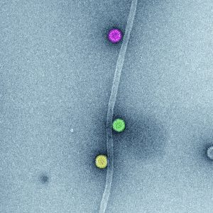 Electron micrograph of Vero E6 cells infected with SARS-CoV-2, 8 h post infection. Viral replication organelles. These virus-induced structures accumulate in large clusters in the perinuclear region and primarily contain double-membrane vesicles (DMVs).  See Ogando et al., “SARS-Coronavirus-2 Replication in Vero E6 Cells: Replication Kinetics, Rapid Adaptation, and Cytopathology.” 2020. J. Gen. Virol. doi: 10.1099/jgv.0.001453 PMID 32568027. Courtesy of Ronald Limpens, Montse Bárcena and Eric Snijder, Leiden University Medical Center, the Netherlands.