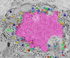 Rotavirus viroplasm. Rotavirus genome replication, packaging of virus genome segments in viral cores, and double-layered particle (DLP) formation occur in membrane- less cytosolic inclusions named viroplasms. Freshly made DLPs bud from viroplasms to rough endoplasmatic reticulum (RER) to become mature triple-layered particles (TLPs). In this process, a transient lipid membrane surrounds immature TLPs. The image represents a high-definition transmission electron micrograph of a viroplasm (magenta) at 6 h post-infection, surrounded by RER containing immature and mature TLPs (orange, yellow, green, red, light blue, dark blue). After glutaraldehyde fixation, samples were stained with uranyl acetate and lead citrate. Acquired images were colored using Adobe Photoshop. Courtesy of Catherine Eichwald, Institute of Virology, University of Zürich.