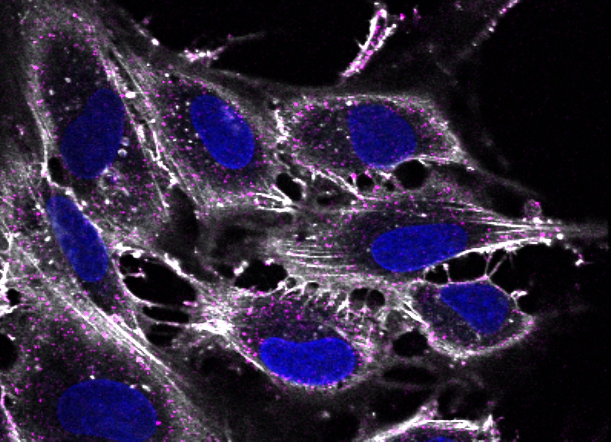 SVG-A glial cells infected with JC polyomavirus labeled with Alexa Fluor 647 (pseudocolored magenta), 5 minutes post internalization. Cells are stained for actin (pseudocolored gray); nuclei are stained with DAPI (blue). Courtesy of Colleen Mayberry and Melissa Maginnis, University of Maine.