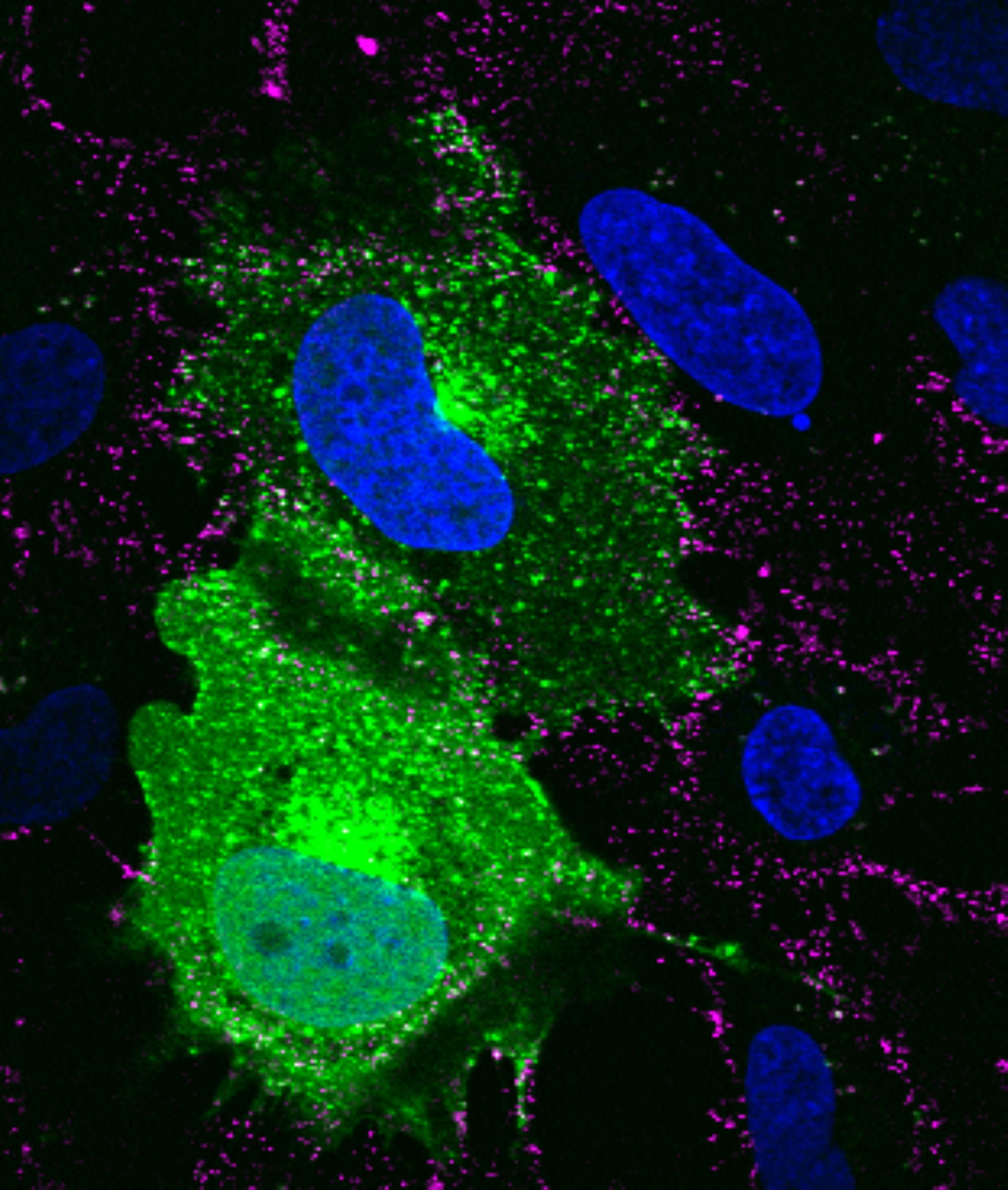 SVG-A glial cells transiently transfected with mEmerald clathrin (green), infected with JC polyomavirus labeled with Alexa Fluor 647 (pseudocolored magenta), 5 minutes post internalization. Nuclei are stained with DAPI (blue). Courtesy of Colleen Mayberry and Melissa Maginnis, University of Maine.
