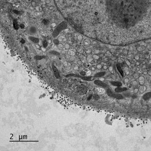 Electron micrograph of Vero E6 cells infected with SARS-CoV-2, 10 h post infection. Overview of an infected cell showing replication organelles (top right) and virus particles released from and associated with the plasma membrane. See Ogando et al., “SARS-Coronavirus-2 Replication in Vero E6 Cells: Replication Kinetics, Rapid Adaptation, and Cytopathology.” 2020. J. Gen. Virol. doi: 10.1099/jgv.0.001453 PMID 32568027. Courtesy of Ronald Limpens, Montse Bárcena and Eric Snijder, Leiden University Medical Center, the Netherlands.