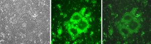 Adaptation of canine distemper virus (CDV) to human SLAM (CD150). Wild-type CDV 5804P-eGFP/H strain adapts to grow in human SLAM-expressing Vero cells (Vero-hSLAM) within five blind-passages and reproduces a skull-like syncytium, suggesting that CDV may be a potential pathogen of humans in future! Left, phase-contrast image of infected Vero-hSLAM; center, eGFP fluorescence; right, merge. Background: Expansions of the CDV host range have taken place several times during the last decades. For example, infections of monkeys (Macaca fuscata and Macaca mulata) with CDV, resulting in quite high case fatality rates, have been observed. These results suggest that CDV may eventually infect humans and spread in the human population. We investigated the requirements of wild-type CDV adaptation to the cognate human cellular measles virus SLAM receptor. This adaptation process swiftly occurred in only five virus passages. We found that adaptation of CDV to hSLAM occurred with only one amino acid exchange in the viral H protein (Manuscript in preparation). Courtesy of Jianjun Zhao1,2 & Chris. D. Richardson2 1. College of Animal Science and Veterinary Medicine, Heilongjiang Bayi Agricultural University, Daqing 163319, China; E-mail: zhaojianjun1211@163.com 2. The Department of Microbiology and Immunology, Dalhousie University, Halifax, B3H1X5, NS, Canada; E-mail: chris.richardson@dal.ca