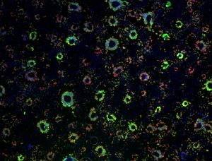 Epithelial cell monolayer (ARPE-19) infected with human cytomegalovirus, costained for viral immediate-early proteins 1/2 (green) and viral single-stranded DNA binding protein UL57 (red). Nuclei are stained with Hoechst 33342 (blue). See Vo, M., A. Aguiar, M.A. McVoy, and L. Hertel. 2020. Cytomegalovirus Strain TB40/E Restrictions and Adaptations to Growth in ARPE-19 Epithelial Cells. Microorganisms 8:E615. doi: 10.3390/microorganisms8040615. Courtesy of Alexis Aguiar and Laura Hertel, UC San Francisco.